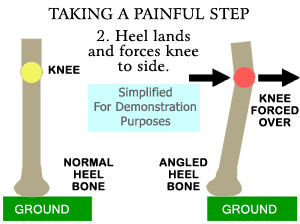 Orthotics Patterns Orthotics